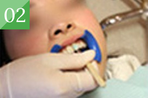 whitening_image05