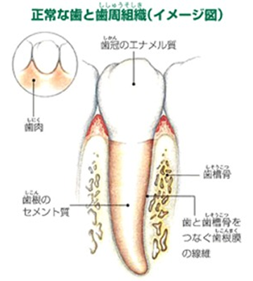 periodontal_image02