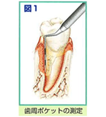 periodontal_image05